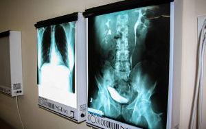 Przykładowe zajęcia na kierunku Technik Elektroradiolog (3)