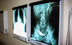 Przykładowe zajęcia na kierunku Technik Elektroradiolog (3)